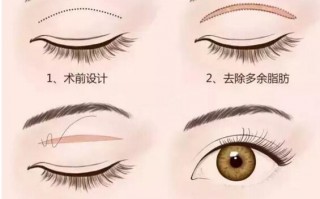 眼睛防滑勾怎么装 技巧，眼镜防滑套怎么装
