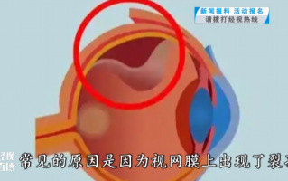 右眼变形什么原因，右眼变形什么原因引起的