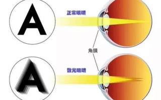 定制隐形眼镜加散光多少钱，定制隐形眼镜多少钱